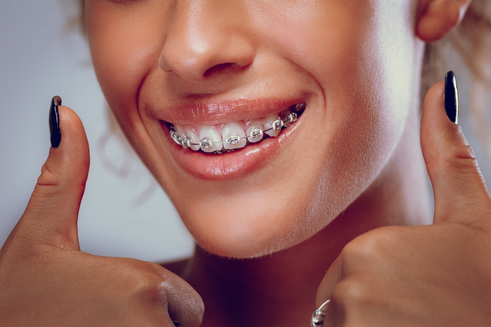 Ultimate Guide to Orthodontic Correction